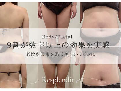 レスプロンディール(Resplendir)の写真