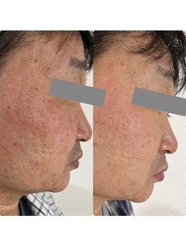 ワイエス サロン 東陽町(Ys Salon)/男性も若見え