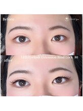 スウィートアイズ(Sweet eyes)/LEDバインドロックに興味あり！