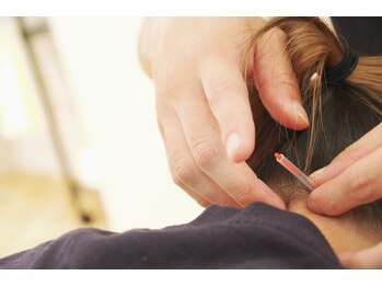 ネイビー鍼灸指圧治療院(NAVY鍼灸指圧治療院)/鍼施術も承ります!