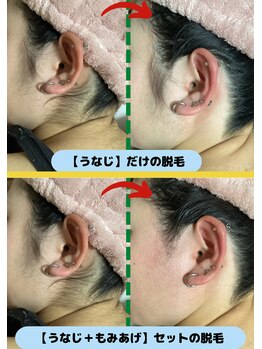 ディスイズミー シュガーリング(This is me Sugaring)/【シュガー】うなじ～もみあげ