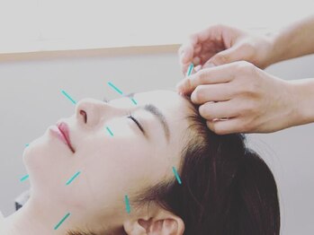 ほりうちケア鍼灸院整骨院の写真/《【人気No.1☆】小顔・美肌美容鍼60分￥6000》女性に大人気！美容鍼で血流とリンパを促進し小顔を叶える！