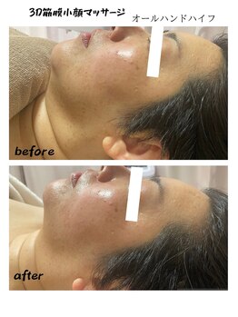 フローレント(Florent)/3D筋膜小顔マッサージ