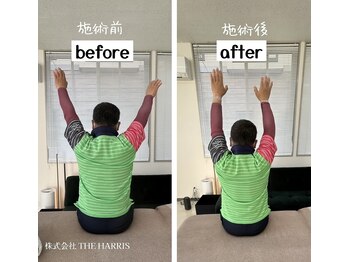 沼田整体スタジオ/施術ビフォーアフター（肩）