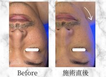 サロンビー 赤坂(SalonB)