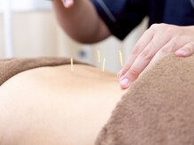 あうる鍼灸接骨院 整体院/【鍼灸】肩こり/腰痛/疲労/歪み