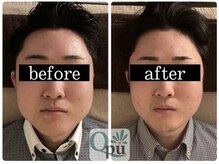 キュープ 富士店(Qpu)/大きく見えるのは脂肪ではなく‥