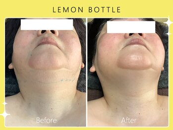 シロカネ 光の森店(SHIROKANE)/レモンボトル☆