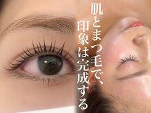 スウィート リリー(Sweet Lily)