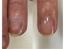 ロンディネ(Rondine)/自爪育成