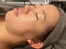 ラルミエール 緑店はなれ(la lumiere)/贅沢スペシャルコース