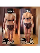 ビハーラ 門司店/夏直前★痩身ビフォーアフター★