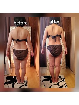 ビハーラ 門司店/夏直前★痩身ビフォーアフター★