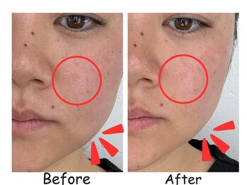 ふうき堂/ビフォーアフター