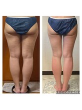 ビボディラボ 海老名店(美Body Labo)/代謝