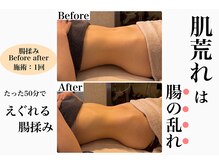 ムーロ バイ ミュー(muro. by mieux)の雰囲気（美肌は『腸』から！インナーケアもサポート！効果実感の腸揉み）
