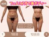 他で痩せなかった人必見★フェム×痩身3か月-10cmくびれ誕生★今だけ49800→