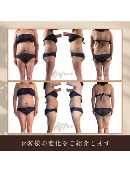 ボディケアサロン アイリフ(airef)/2回でもすっきり