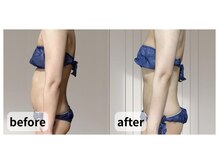 ニーコ 新宿御苑前(Niico)/30代後半 女性/150分コース×3回