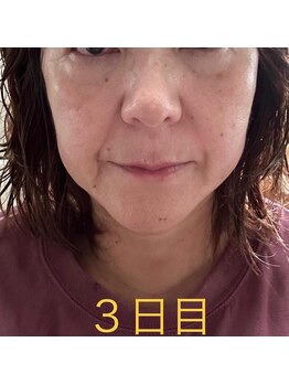 セントセシリア/GUINOT VARの効果！3日目