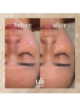 ウリ(uli beauty)/比較写真