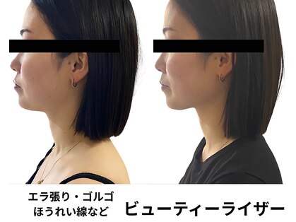トータルビューティーサロンリア(Li'a)の写真
