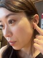ミル(MIR)&nbsp;敏感肌でした。美容が好きだからこそ合わないものに悩んだ経験も