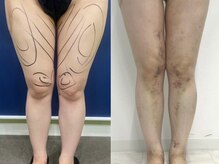 リメイククリニカルビューティー(Remake clinical beauty)/回復促進！ダウンタイムケア