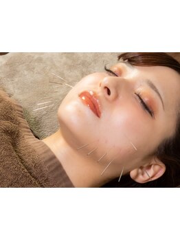 鍼灸施術を受けたい