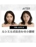 ～予約殺到中～ 女性小顔職人就任 極上小顔術90分 【特別キャンペーン】