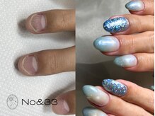 ナンバーアンドスリーサン(No&33)の雰囲気（足の巻き爪、深爪はその日に解決お任せください）