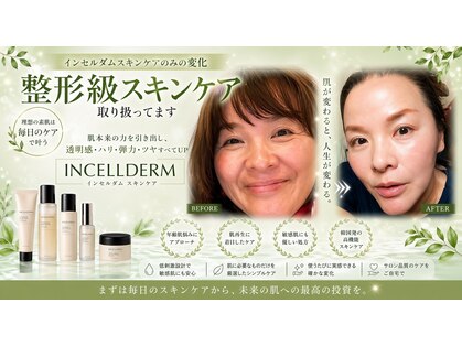 ベリッシマ(Bellissima)の写真