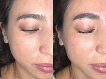 キャンバス 初台(CANVAS)/- HBL - &nbsp;Before/After