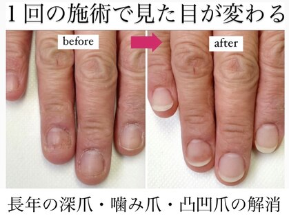 トイロ(toiro)の写真