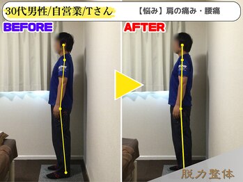 幸せのもり整体院/30代男性/自営業/Tさん