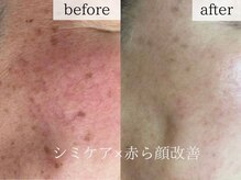 エステの森ジュジュの雰囲気(お客様の肌悩み/肌質/当日のコンディションを確認し施術を提案☆)