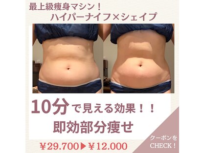 ビーグレイス(Vigrace)の写真