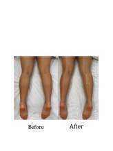 クリスタリオサーナエヌ 自由が丘(crystallo Sana N)/スピーディーにスリムな美脚へ