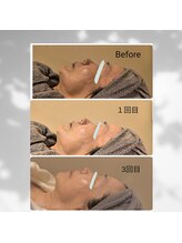 マイルーム(my room)/