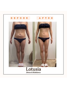 ルトゥーシア(Lotusia)/全身　before→after