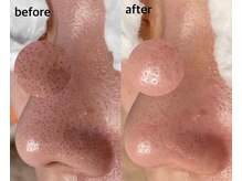 毛穴専科/毛穴洗浄+白玉ワックス メンズ◎