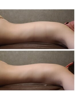 ウォーマル(warmaL)/ホットストーン+アロマタッチ