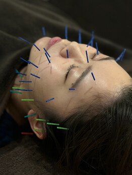 宮町鍼灸整骨院/化粧ノリアップ♪