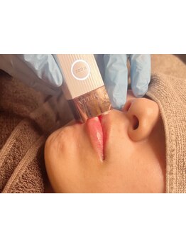 美白ケアをしたい