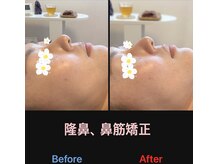 美容矯正サロン レレポノ(LELEPONO)/