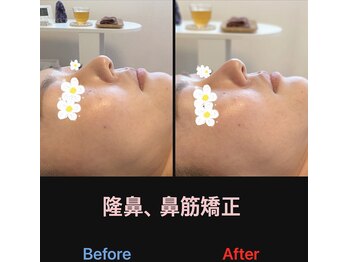 美容矯正サロン レレポノ(LELEPONO)/