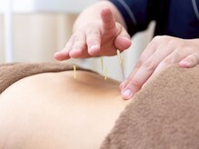 あうる鍼灸接骨院 整体院/【鍼灸】肩こり/腰痛/疲労/歪み