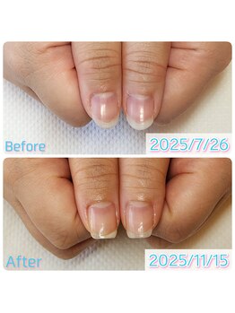 スペシャルハンドケア