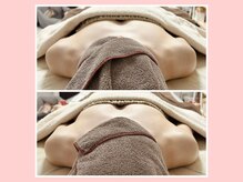 イッツソウ(It's so...)/ビフォーアフター写真