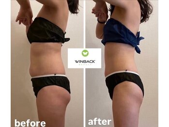 シエルエトワール 唐津店(Ciel Etoile)/WINBACK90分　お腹ウエスト　1回